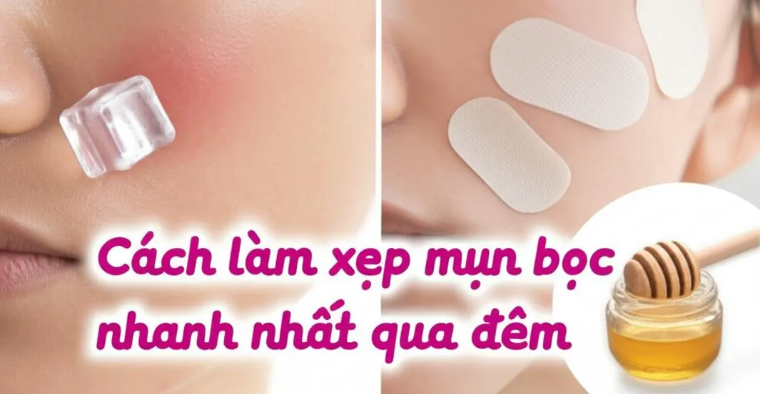 Bí quyết đánh bay mụn bọc chỉ sau một đêm: Hiệu quả bất ngờ!