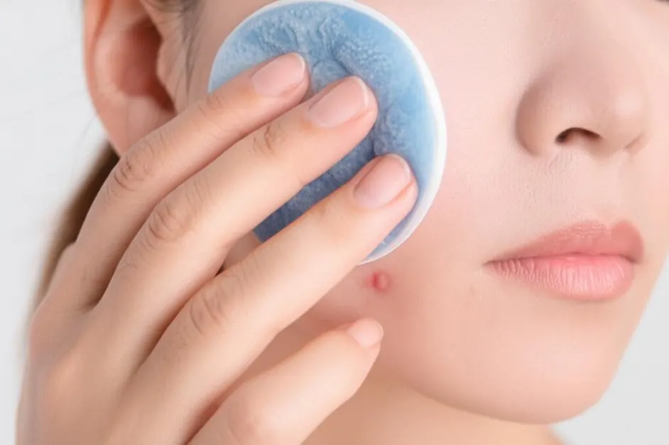 Bí quyết giảm sưng đỏ mụn bọc cấp tốc qua đêm: Đánh bay mụn viêm chỉ sau một giấc ngủ!
